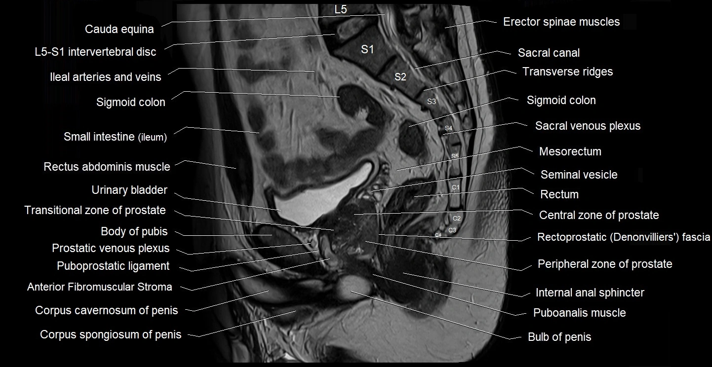 male pelvis sagittal cross sectional anatomy 3T mri image 25.webp